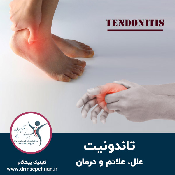 تاندونیت-tendonitis
