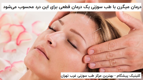 درمان میگرن با طب سوزنی در بهترین کلینیک طب سوزنی غرب تهران